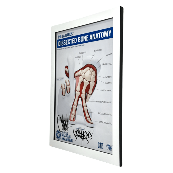 Dissected Bone Anatomy LA Hands 70x55 Cm Framed Print By Slick X Freeny (Signed) 02 | Monkey Paw Mexico