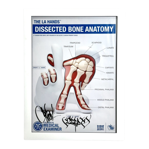 Dissected Bone Anatomy LA Hands 70x55 Cm Framed Print By Slick X Freeny (Signed) 01 | Monkey Paw Mexico